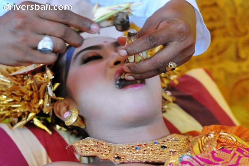 Tooth Filing (Potong Gigi) ceremony is one of the most important ceremonies in Bali